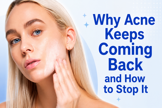 Why Acne Keeps Coming Back and How to Stop It